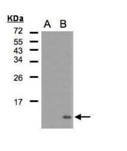 Invitrogen CCL5 (RANTES) Polyclonal Antibody 100 &mu;L | Buy Online | Invitrogen&trade; | Fisher Scientific