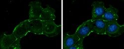 Invitrogen&trade;&nbsp;ZO-1 Polyclonal Antibody