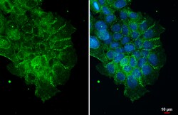 Invitrogen ZO-1 Polyclonal Antibody 100 &mu;L | Buy Online | Invitrogen&trade; | Fisher Scientific