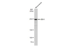 Invitrogen ZO-1 Polyclonal Antibody 100 &mu;L | Buy Online | Invitrogen&trade; | Fisher Scientific