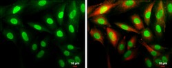 Invitrogen Cyclin D1 Polyclonal Antibody 100 &mu;L; Unconjugated:Antibodies,
