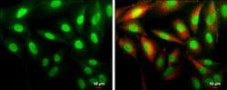 Invitrogen Cyclin D1 Polyclonal Antibody 100 &mu;L; Unconjugated:Antibodies,