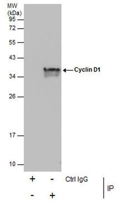 Invitrogen Cyclin D1 Polyclonal Antibody 100 &mu;L; Unconjugated:Antibodies,