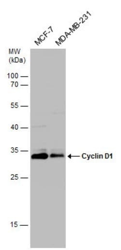 Invitrogen Cyclin D1 Polyclonal Antibody 100 &mu;L; Unconjugated:Antibodies,