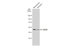 Invitrogen GFAP Polyclonal Antibody 100 &mu;L; Unconjugated:Antibodies,