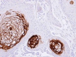 Invitrogen CEA Polyclonal Antibody 100 &mu;L | Buy Online | Invitrogen&trade; | Fisher Scientific