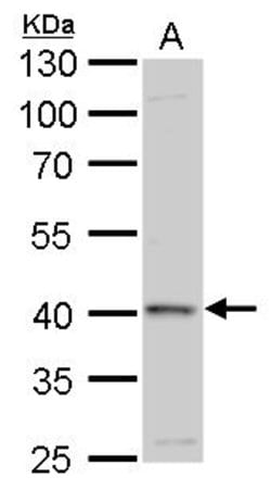 Invitrogen GALK1 Polyclonal Antibody 100 &mu;L | Buy Online | Invitrogen&trade; | Fisher Scientific
