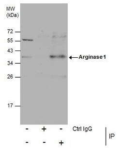 Invitrogen Arginase 1 Polyclonal Antibody 100 &mu;L | Buy Online | Invitrogen&trade; | Fisher Scientific