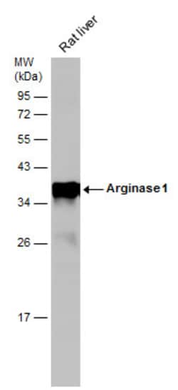 Invitrogen Arginase 1 Polyclonal Antibody 100 &mu;L | Buy Online | Invitrogen&trade; | Fisher Scientific