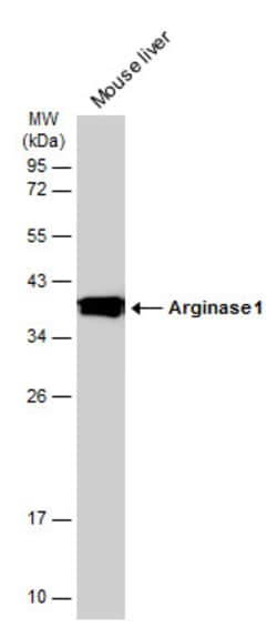 Invitrogen Arginase 1 Polyclonal Antibody 100 &mu;L | Buy Online | Invitrogen&trade; | Fisher Scientific