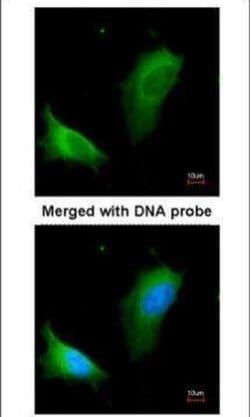 Invitrogen Arginase 1 Polyclonal Antibody 100 &mu;L; Unconjugated:Antibodies,