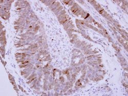 Invitrogen Phospholamban Polyclonal Antibody 100 &mu;L | Buy Online | Invitrogen&trade; | Fisher Scientific