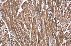 Invitrogen ANP Polyclonal Antibody 100 &mu;L; Unconjugated:Antibodies,
