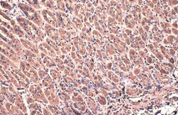 Invitrogen beta Actin Polyclonal Antibody 100 &mu;L; Unconjugated:Antibodies,