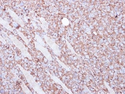 Invitrogen beta Actin Polyclonal Antibody 100 &mu;L; Unconjugated:Antibodies,