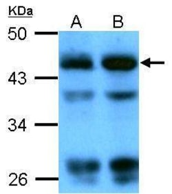 Invitrogen beta Actin Polyclonal Antibody 100 &mu;L; Unconjugated:Antibodies,