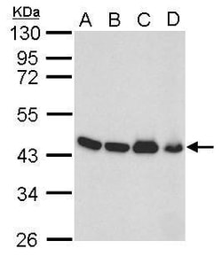 Invitrogen beta Actin Polyclonal Antibody 100 &mu;L; Unconjugated:Antibodies,