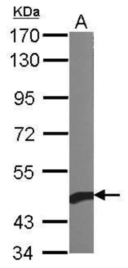 Invitrogen beta Actin Polyclonal Antibody 100 &mu;L; Unconjugated:Antibodies,
