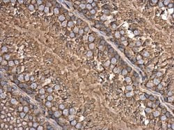 Invitrogen beta Actin Polyclonal Antibody 100 &mu;L; Unconjugated:Antibodies,