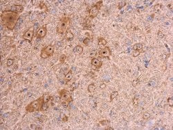 Invitrogen beta Actin Polyclonal Antibody 100 &mu;L; Unconjugated:Antibodies,