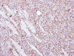 Invitrogen beta Actin Polyclonal Antibody 100 &mu;L; Unconjugated:Antibodies,