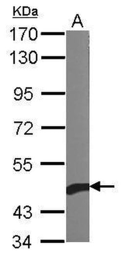 Invitrogen beta Actin Polyclonal Antibody 100 &mu;L; Unconjugated:Antibodies,