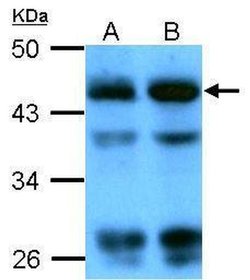 Invitrogen beta Actin Polyclonal Antibody 100 &mu;L; Unconjugated:Antibodies,