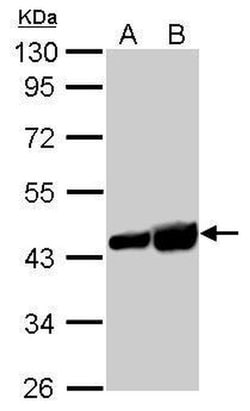 Invitrogen beta Actin Polyclonal Antibody 100 &mu;L; Unconjugated:Antibodies,