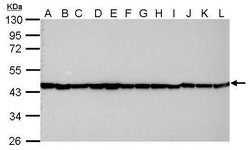 Invitrogen beta Actin Polyclonal Antibody 100 &mu;L; Unconjugated:Antibodies,