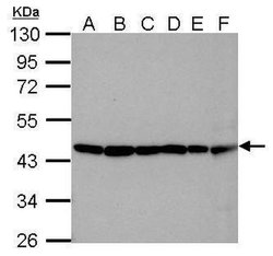 Invitrogen beta Actin Polyclonal Antibody 100 &mu;L; Unconjugated:Antibodies,