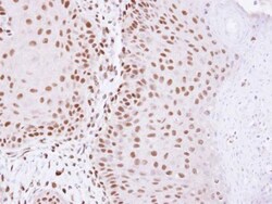 Invitrogen HDAC2 Polyclonal Antibody 100 &mu;L; Unconjugated:Antibodies,