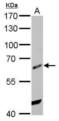 Invitrogen HDAC2 Polyclonal Antibody 100 &mu;L; Unconjugated:Antibodies,