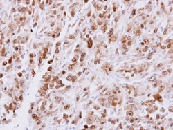 Invitrogen CDT1 Polyclonal Antibody 100 &mu;L; Unconjugated:Antibodies,