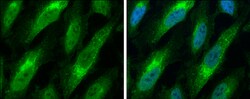 Invitrogen Bax Polyclonal Antibody 100 &mu;L; Unconjugated:Antibodies,