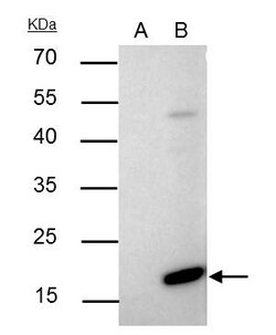 Invitrogen Bax Polyclonal Antibody 100 &mu;L; Unconjugated:Antibodies,