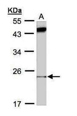 Invitrogen Bax Polyclonal Antibody 100 &mu;L; Unconjugated:Antibodies,