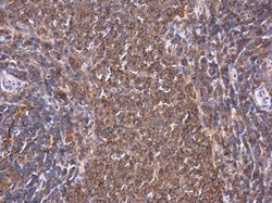 Invitrogen PKC theta Polyclonal Antibody 100 &mu;L; Unconjugated:Antibodies,