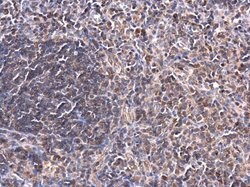 Invitrogen PKC theta Polyclonal Antibody 100 &mu;L; Unconjugated:Antibodies,