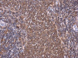 Invitrogen PKC theta Polyclonal Antibody 100 &mu;L; Unconjugated:Antibodies,
