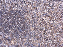 Invitrogen PKC theta Polyclonal Antibody 100 &mu;L; Unconjugated:Antibodies,