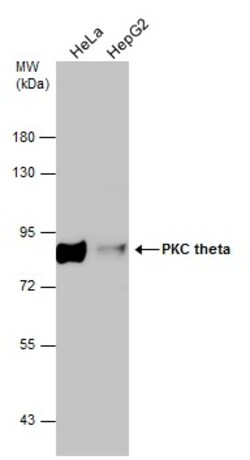 Invitrogen PKC theta Polyclonal Antibody 100 &mu;L; Unconjugated:Antibodies,
