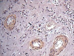 Invitrogen Vinculin Polyclonal Antibody 100 μL; Unconjugated:Antibodies,