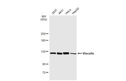 Invitrogen Vinculin Polyclonal Antibody 100 μL; Unconjugated:Antibodies,
