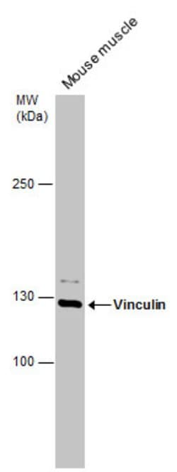 Invitrogen Vinculin Polyclonal Antibody 100 μL; Unconjugated:Antibodies,
