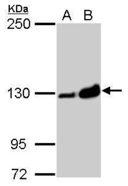 Invitrogen Vinculin Polyclonal Antibody 100 μL; Unconjugated:Antibodies,