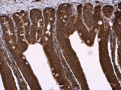 Invitrogen NPR3 Polyclonal Antibody 100 &mu;L; Unconjugated:Antibodies,