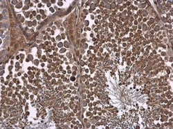 Invitrogen NPR3 Polyclonal Antibody 100 &mu;L; Unconjugated:Antibodies,