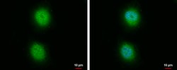 Invitrogen PP5 Polyclonal Antibody 100 &mu;L; Unconjugated:Antibodies,