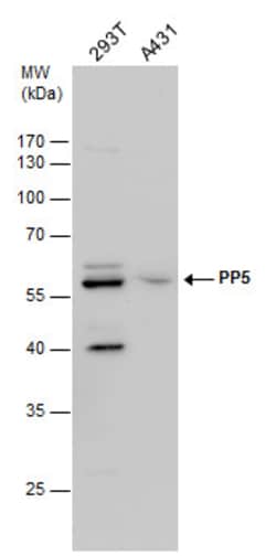 Invitrogen PP5 Polyclonal Antibody 100 &mu;L; Unconjugated:Antibodies,