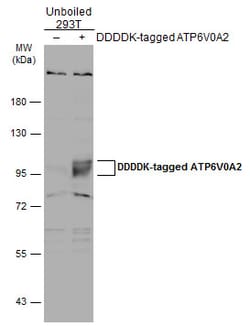 Invitrogen ATP6V0A2 Polyclonal Antibody 100 &mu;L; Unconjugated:Antibodies,